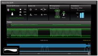 Laerdal QCPR